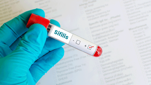 HPV, herpes e sífilis: DSTs que causam feridas, verrugas e desconforto